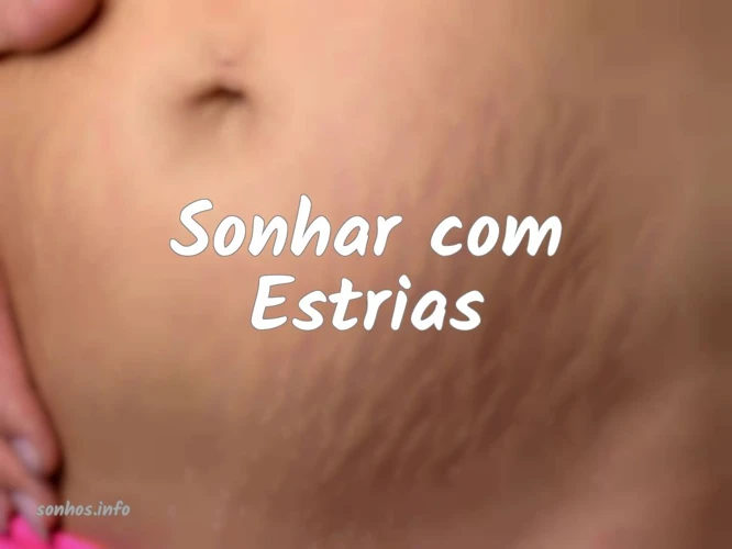 Interpretações Para Sonhar Com Estria